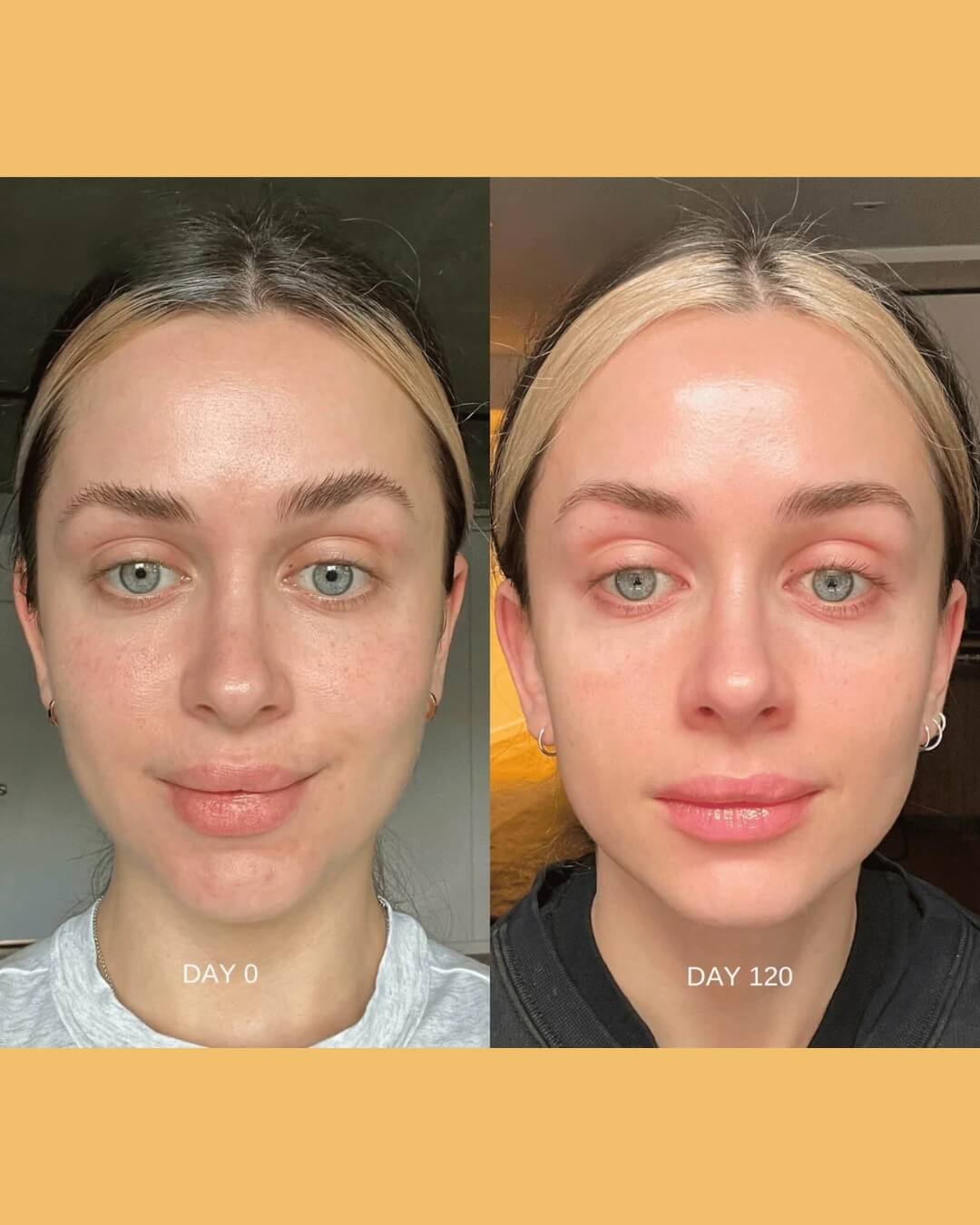Ultimate Glow Moisturizer