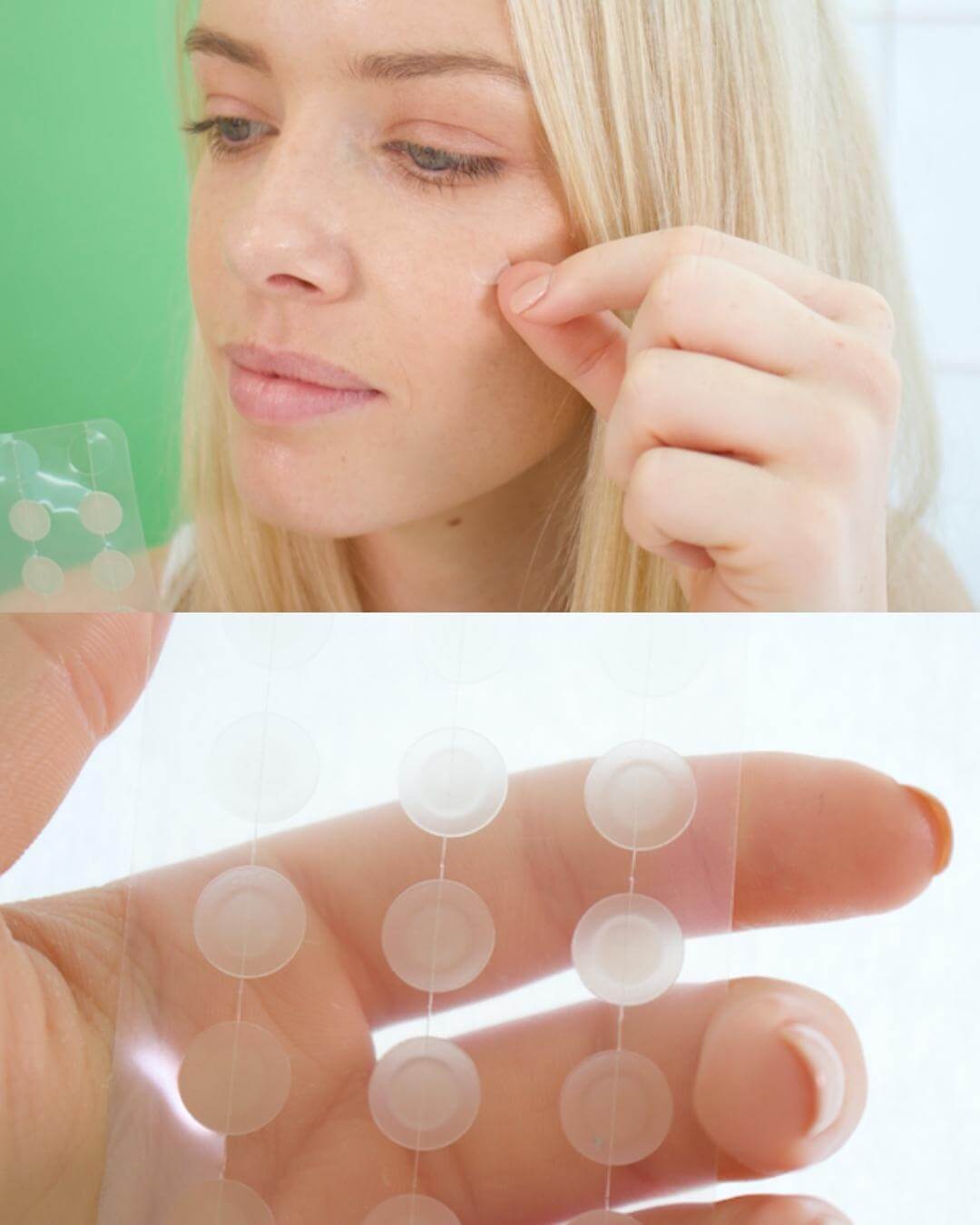 Perfect Pimple Patch